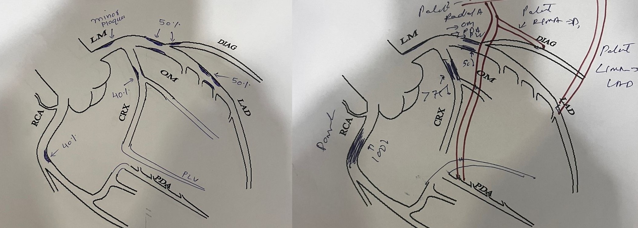 Poor Surveillance: Why We Are Losing the War on Heart Disease in Diabetes